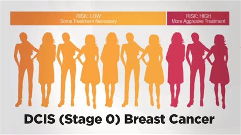 Dcis Stage 0 Breast Cancer And The Oncotype Dx Dcis Score Youtube