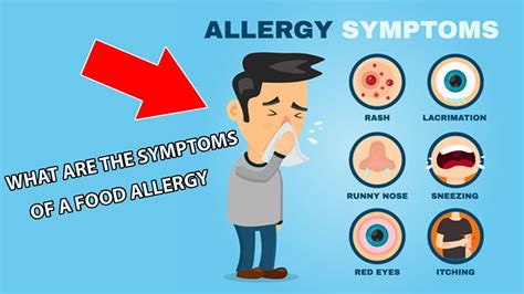 symptoms   food allergy allergies allergies youtube