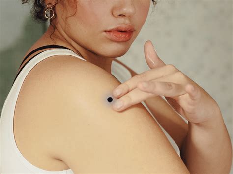 What To Know If Your Weird Mole Turns Out To Be A Blue Nevus Self