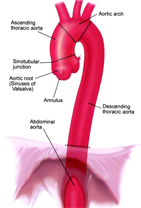 thoracic  abdominal aortic aneurysms circulation