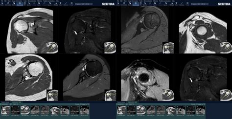 front page background radiology template reports