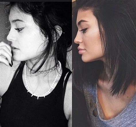 kylie jenner s lips before and after pictures of her pout