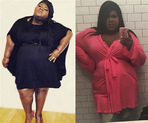 Gabourey Sidibe’s Surgery Why She Decided To Go Under The