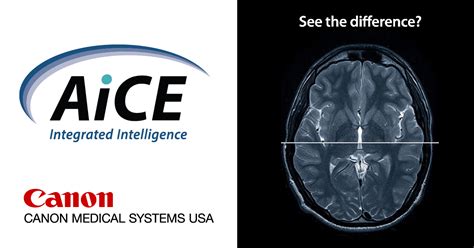 aice challenge magnetic resonance promotion canon medical systems usa