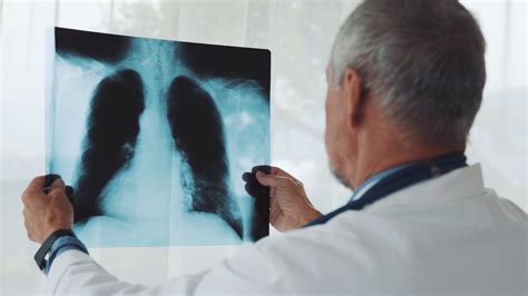 Senior Doctor Looking At Chest X Ray In His Office Male Doctor