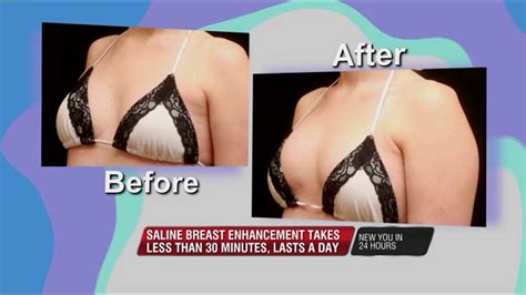 Temporary Breast Enhancements Offered For Indecisive Patients