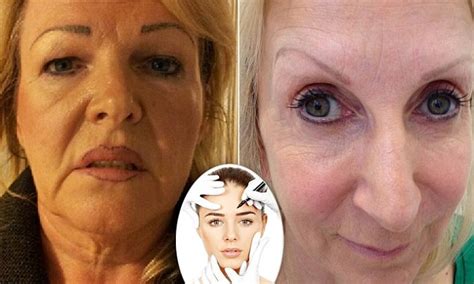 permanent makeup tattoos  celebrity craze