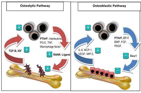 jcm  full text treatment  prevention  bone metastases