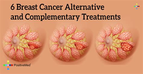 6 breast cancer alternative and complementary treatments