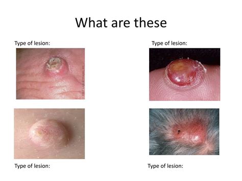 slackers guide  skin lesions powerpoint    id