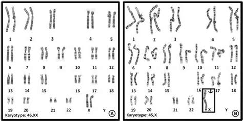 exploring contemporary issues in genetics and society karyotyping