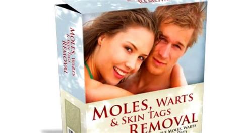 moles warts and skin tags removal review should you use it