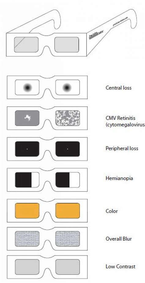 simulator glasses kit low vision aids precision vision