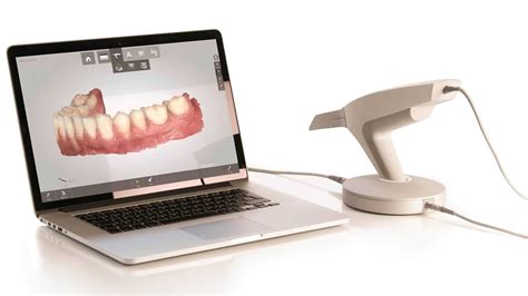 Tecnologías Dentales Escáner Intraoral