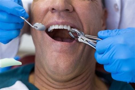 reasons      tooth extraction gentle care dentistry