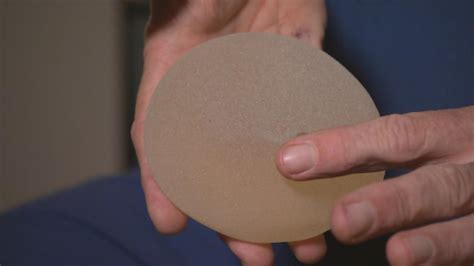 biocell textured breast implants could soon be pulled from the market