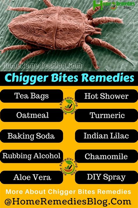 home remedies  treat chigger bites home remedies blog