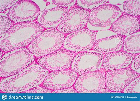 human sperm in the testis morphology under microscope stock image
