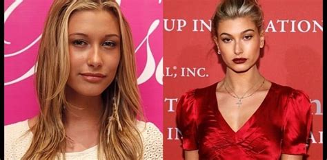 Hailey Baldwin Plastic Surgery Rumors Before And After