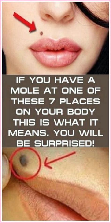 If You Have A Mole At One Of These 7 Places On Your Body This Is What