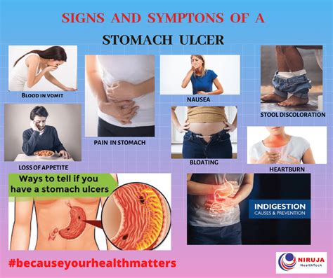 Stomach Ulcer Signs And Symptoms