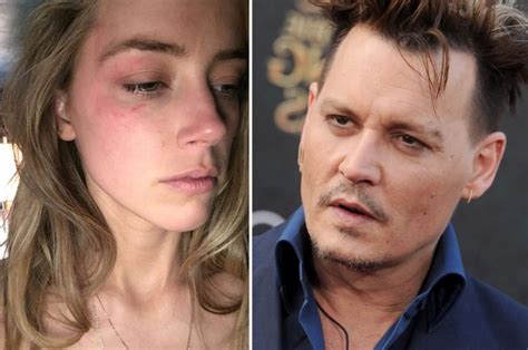 Is Amber Heard Lying For Money Cops Saw No Black Eye Marks