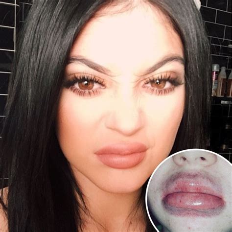 kylie jenner lip challenge produces terrifying results e online au