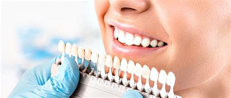 everything you need to know about teeth whitening ottawa