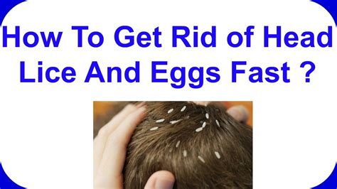 how to get rid of head lice and eggs fast get rid head lice home