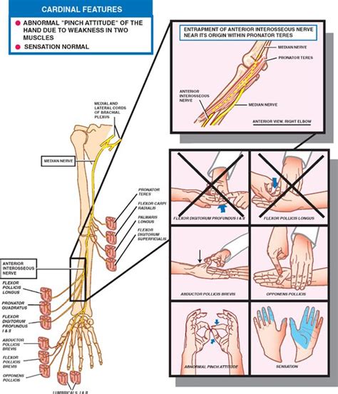 peripheral nerves   peripheral nerve nerve limb