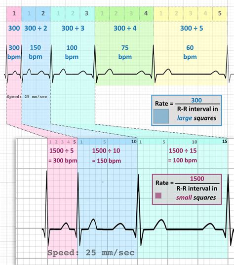 calculating  heart rate ekg ekg strips basic sexiz pix