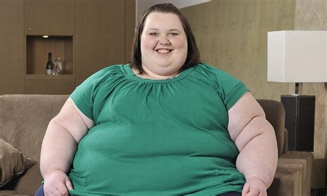 Obesity Crisis The 110 000 Super Obese Patients Who Cost The Nhs £