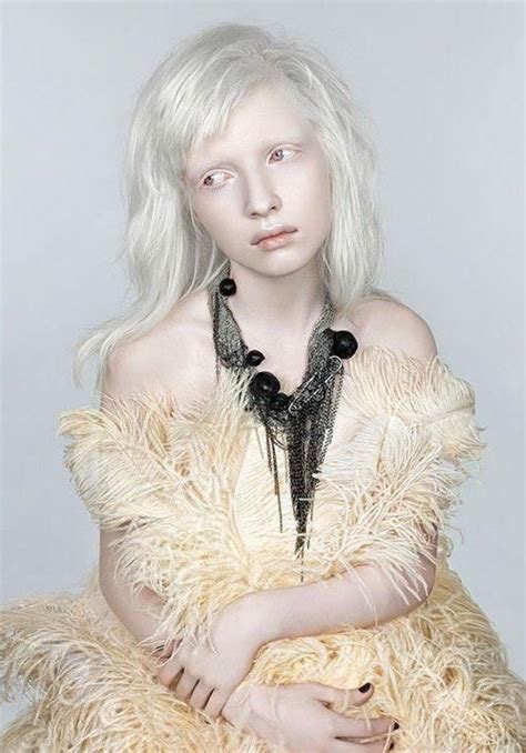 wild flower nastya zhidkova fashion albino model fashion