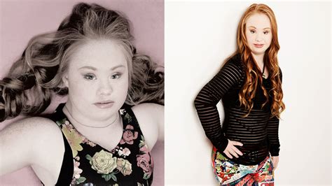 Photos Teen Hopes Modeling Career Shows Down Syndrome Can Be Sexy And