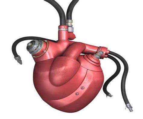 third patient with artificial heart doing well