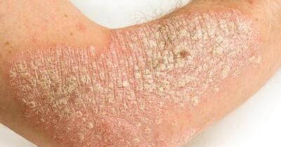 common skin conditions   glance healthgradescom