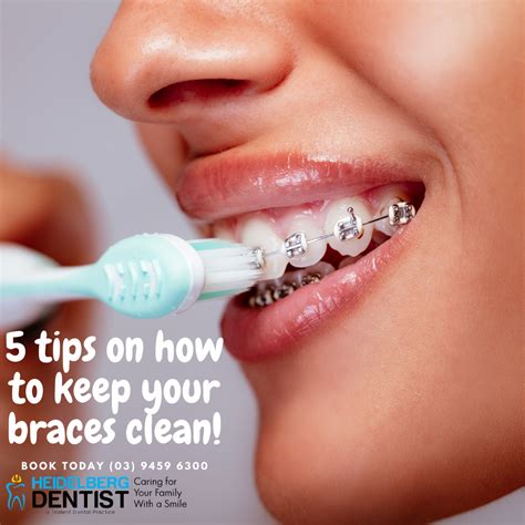 tips      teeth clean    braces