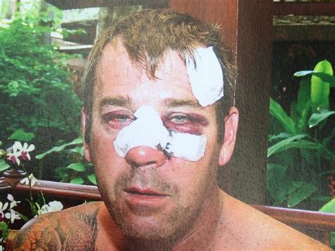 Tourist Beaten By Tuk Tuk Drivers