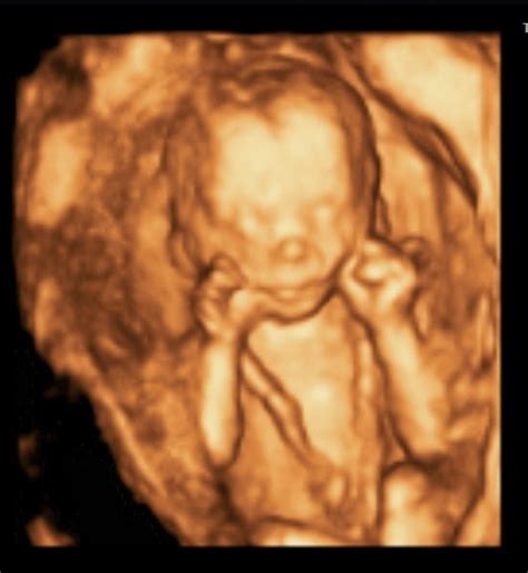 Prices And Packages 3d Elective Ultrasound 4d Elective