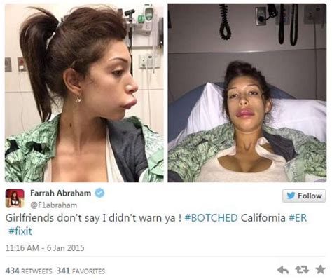porn star farrah abraham s plastic surgery goes terribly wrong she owns it san antonio