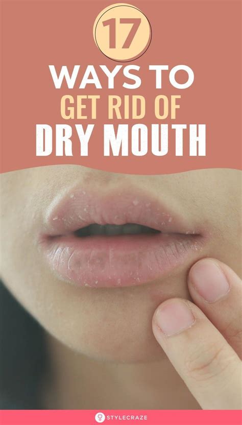 17 Effective Ways To Get Rid Of Dry Mouth In 2020 Remedies For Dry