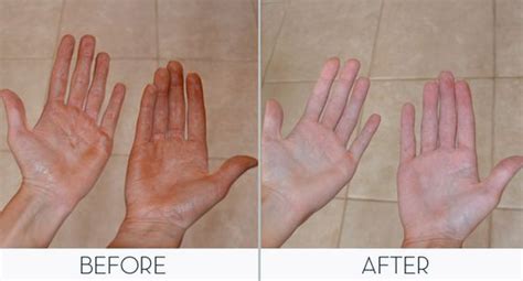 Tan Hands Get Rid Of Tan Tanning Skin Care Best Tanning Lotion