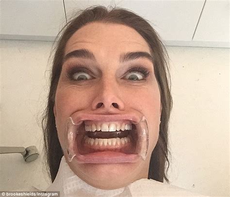 brooke shields shares a scary selfie from the dentist chair daily