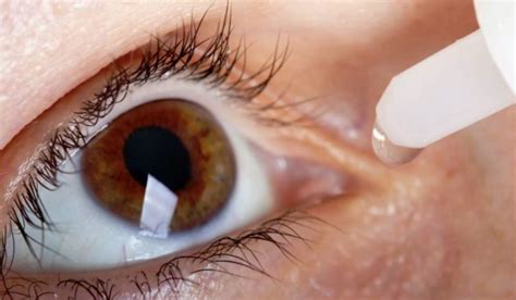gotas para la alergia en los ojos