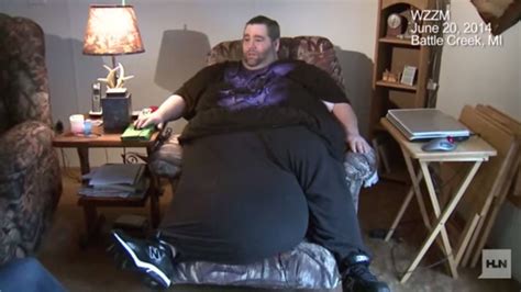 man with 100 pound scrotum in california for crowd funded surgery fox