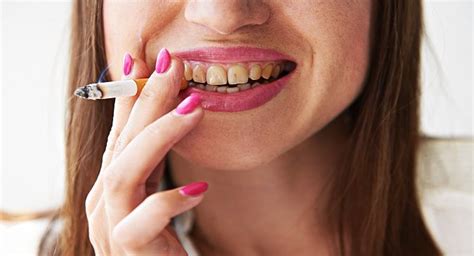 not just lungs and heart tobacco can kill your teeth as well read