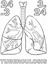 Tuberculosis Coloring Pages La Mundial sketch template