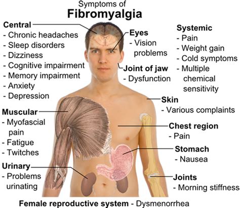 Welcome To Dr Shenoy S Care Hospital Fibromyalgia