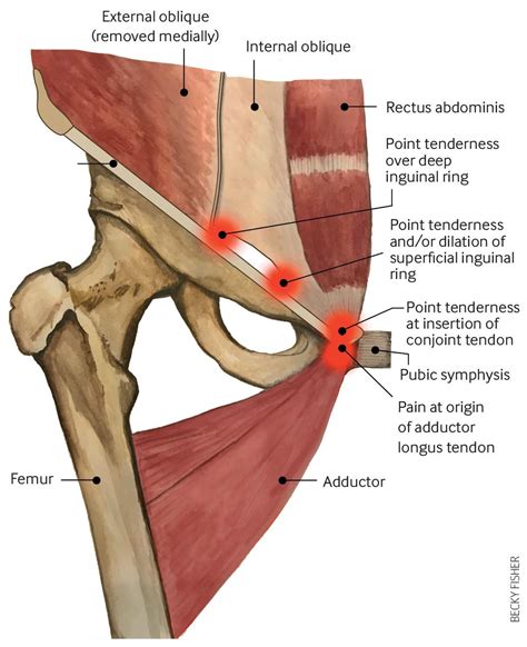 groin anatomy muscles