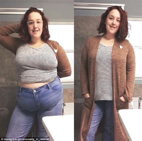 eating disorder sufferer shows stomach pouch on instagram daily mail